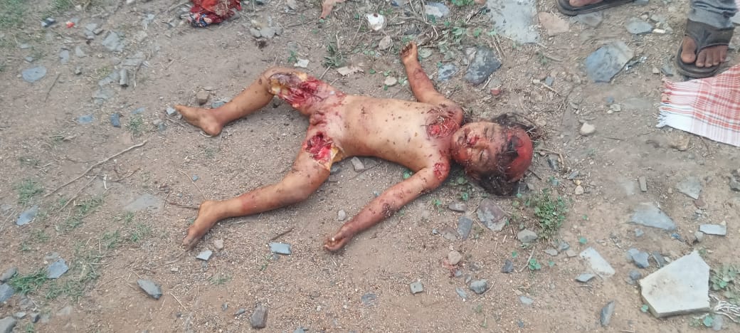 కుక్కల దాడిలో చనిపోయిన చిన్నారి