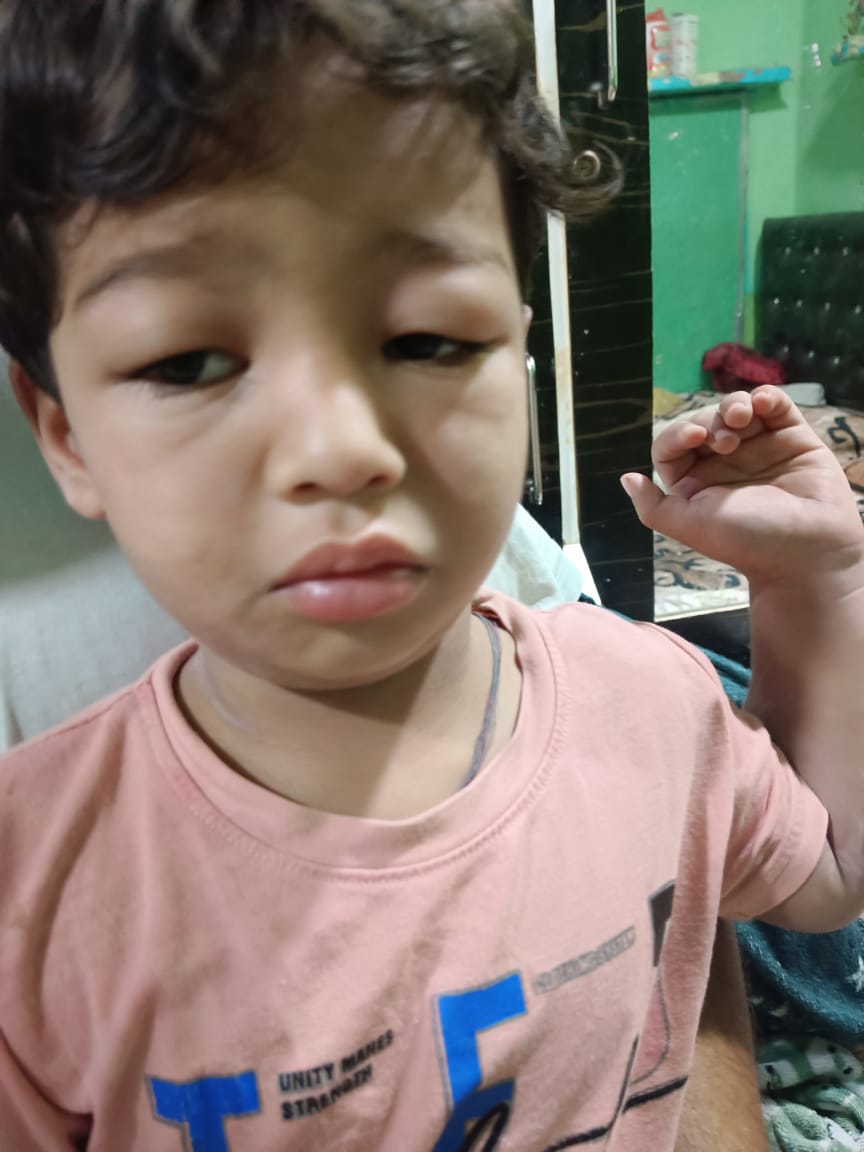 చిన్న పిల్లలకు శాపంగా మారిన నాసిరక వస్తువులు కురుకురె ప్యాకెట్స్ చాక్లెట్లు చిప్స్ ప్యాకెట్లు, లాలిపాప్ పిల్లలు తినే అడ్డమైనవి తయారుచేసి పిల్లల ప్రాణాలు పోతున్న పట్టించుకోని ఫుడ్ సేఫ్టీ ఆఫీసర్లు