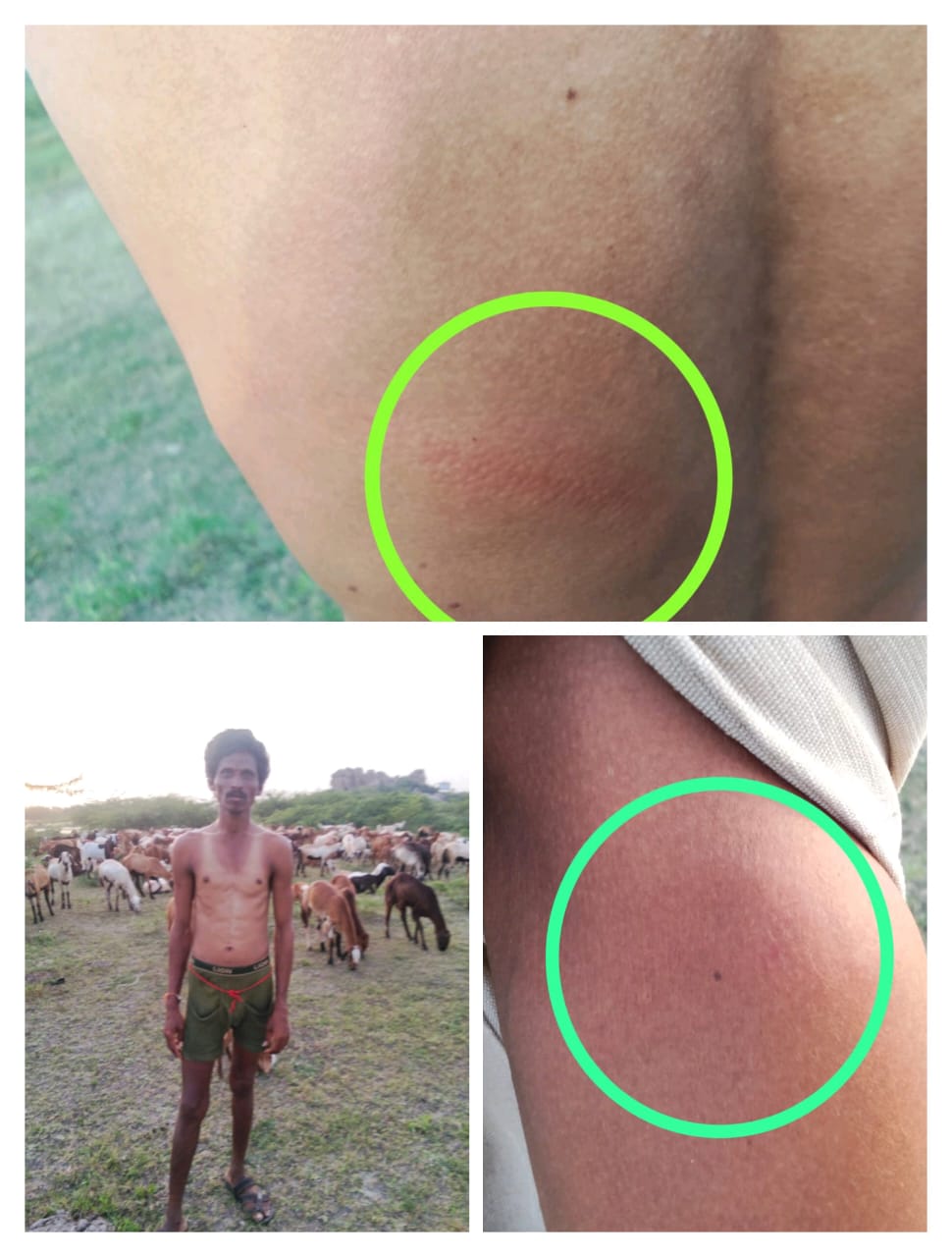 గొర్ల కాపరులపై అకారణంగా దాడి.నీలహళ్లి గ్రామంలో చోటు చేసుకున్న ఘటన..