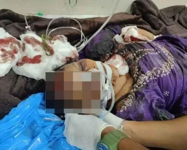 సహజీవన భాగస్వామి హత్య: కుర్చీతో కొట్టి చంపిన శ్రీనివాస్, నిందితుడు పరారీ