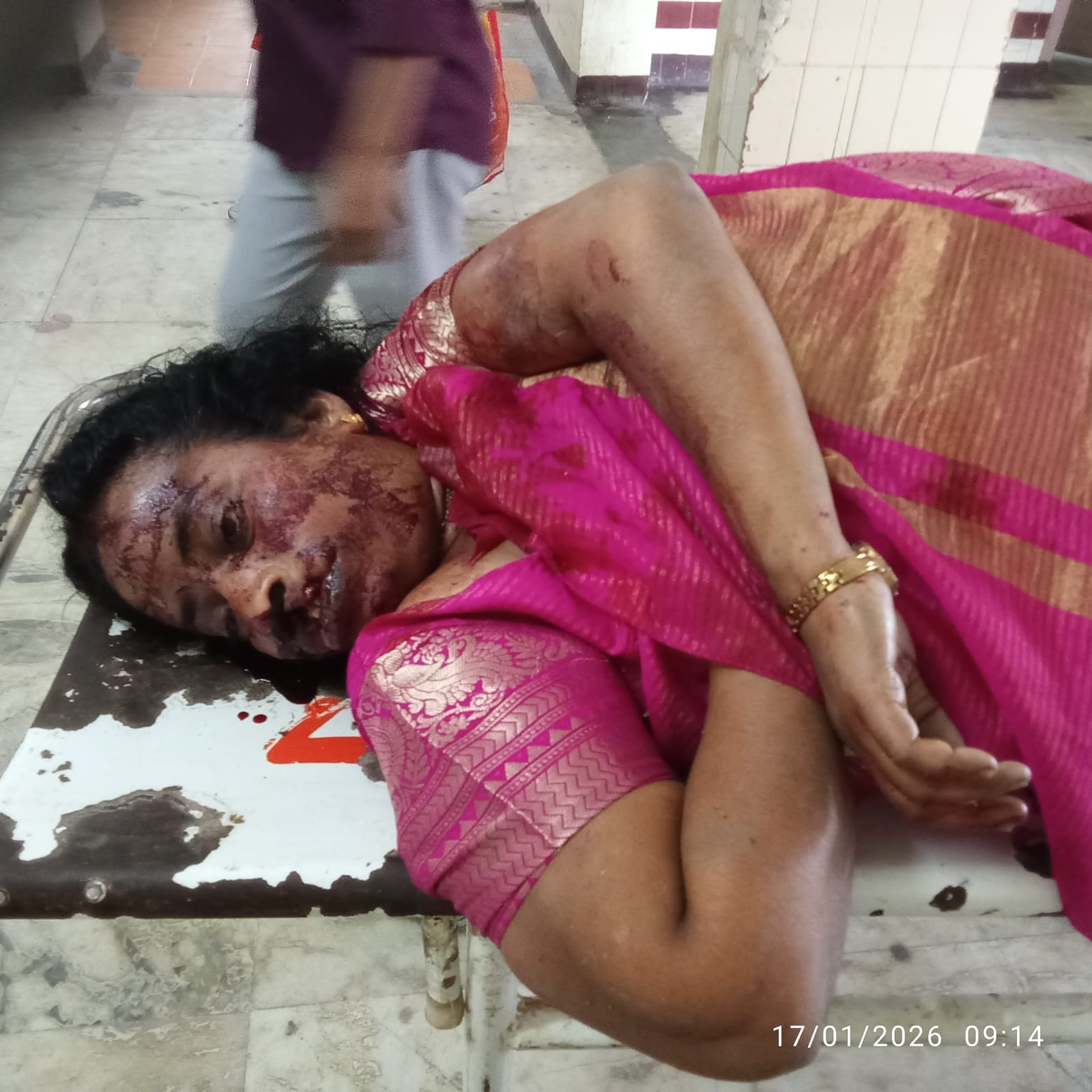 రోడ్డు ప్రమాదంలో ఉపాధ్యాయురాలు మృతి