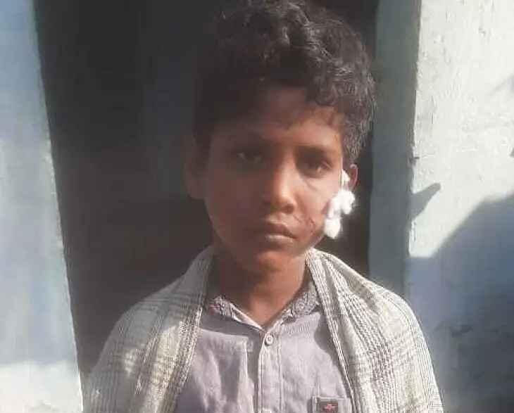 కుక్కకాటుకు పసిప్రాణం బలి: దిబ్బగుడివలసలో రేబీస్‌తో తొమ్మిదేళ్ల బాలుడి మృతి