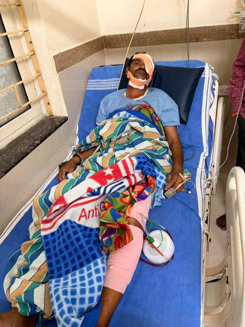 తాటి చెట్టు పైనుండి పడి గీత కార్మికుడికి తీవ్ర గాయాలు